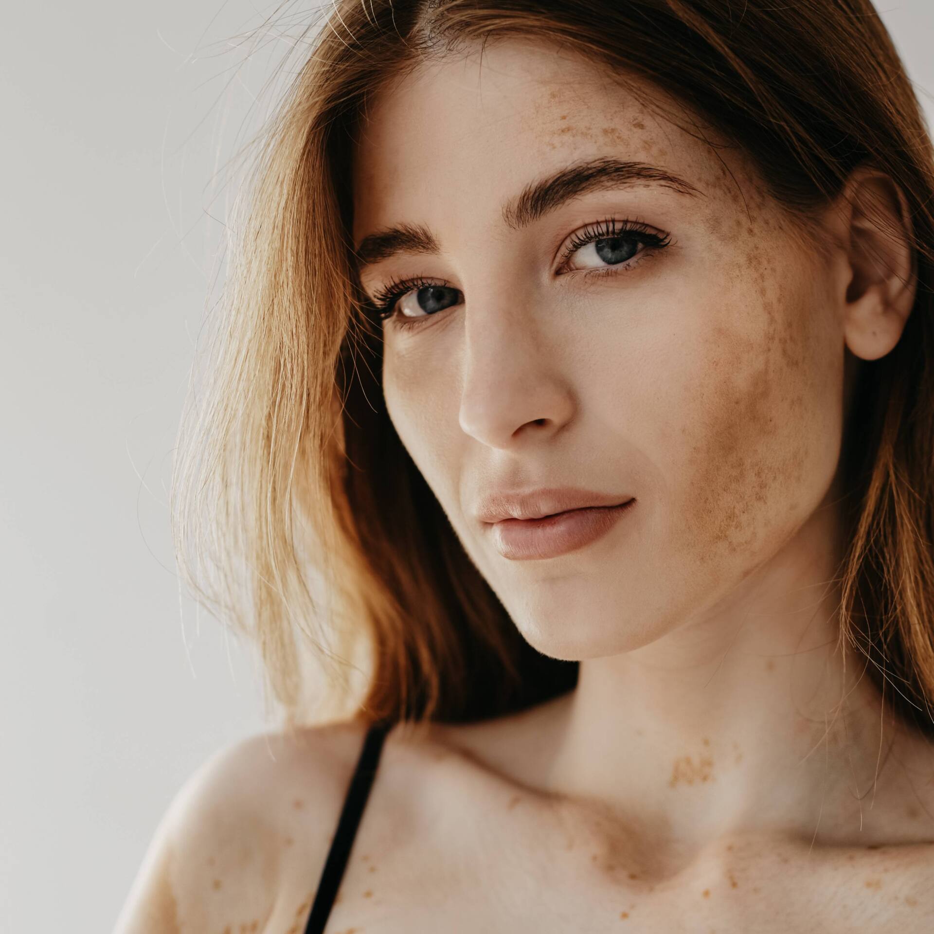 Tratamento para melasma