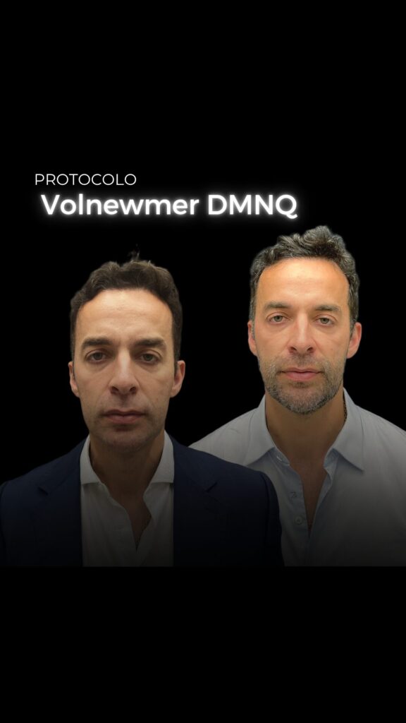 antes e depois volnewmer em porto alegre