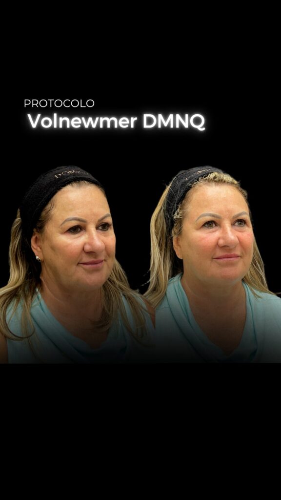 volnewmer em porto alaegre clinica dominique